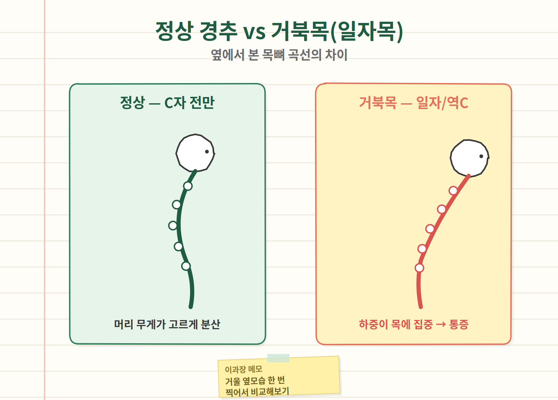 정상 경추 C자 곡선과 거북목 일자목 곡선 비교